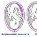 Признаки заболевания преэклампсии после родов у женщин и лечение недуга Послеродовая преэклампсия после процедуры эко донорскими клетками